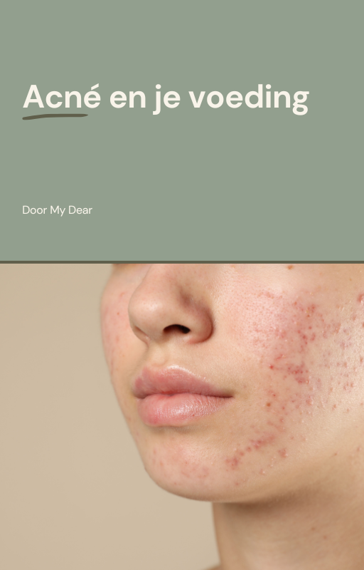 Acné en je voeding - E-book