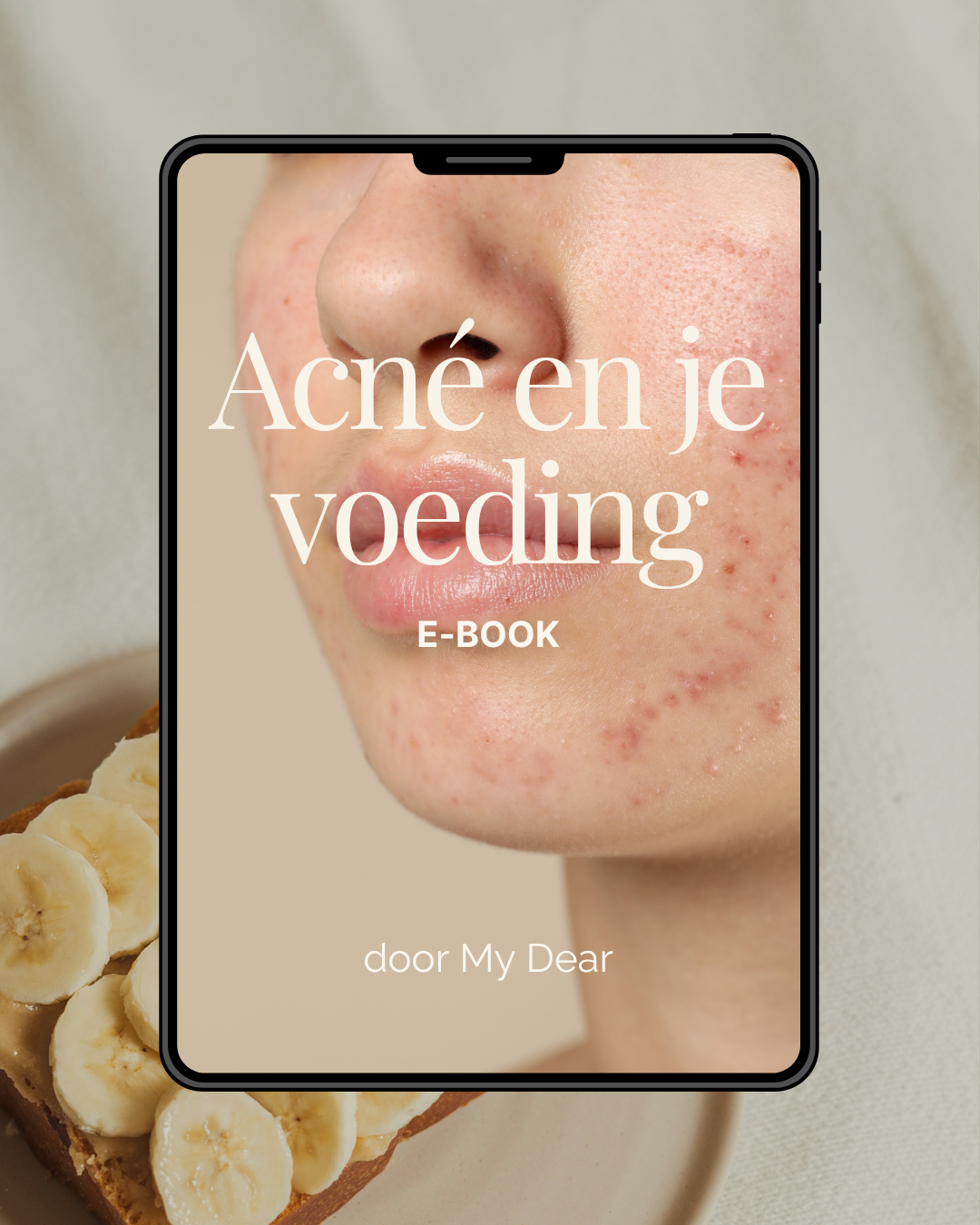 Acné en je voeding - E-book