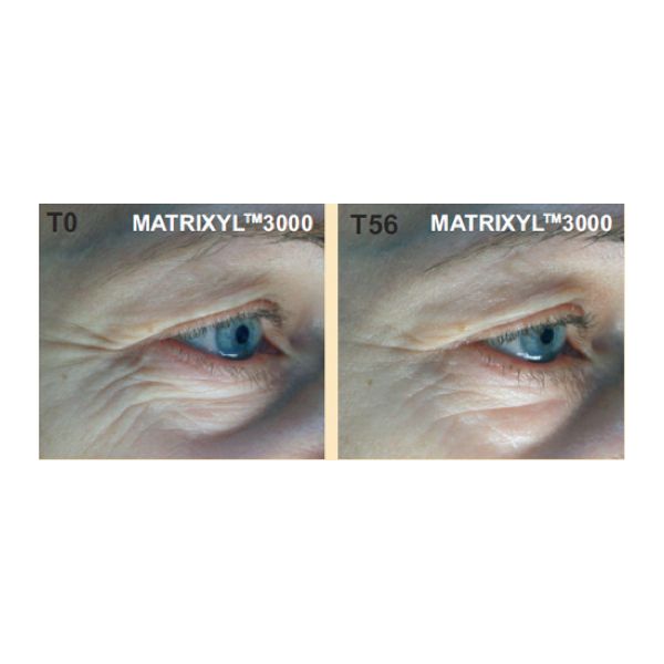 Anti-Gravity Lifting Serum