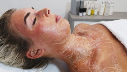 Biopulse Therapy: de ultieme reset voor je huid