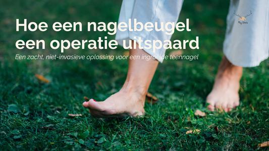 Nagelbeugel of operatie? Waarom een nagelbeugel vaak een beter alternatief is om een ingegroeide teennagel te behandelen