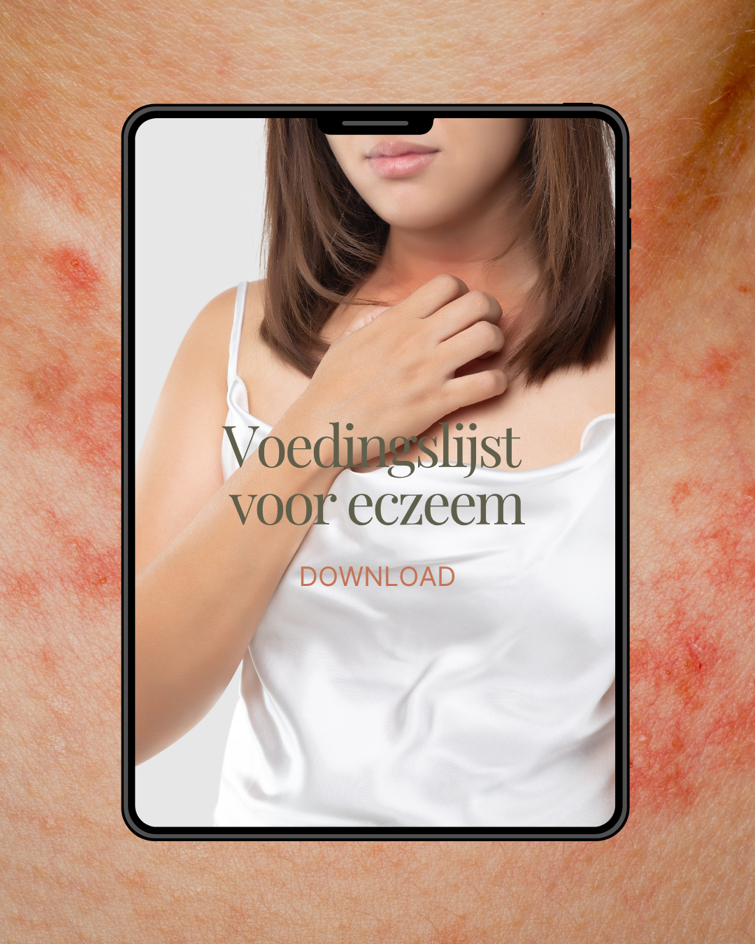 Voedingslijst voor eczeem